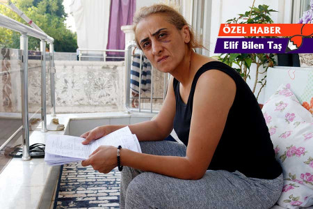 Şiddet mağduru Dilek Göktaş: Çalışamıyorum, bakkala gidemiyorum