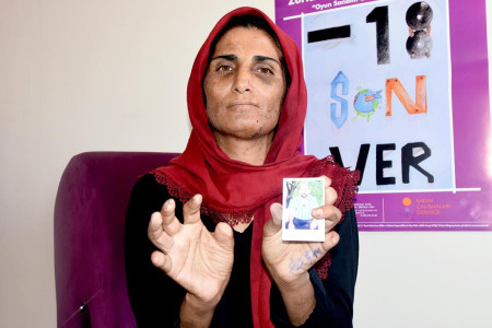 Şiddetin boyutu: Kocası elektrikle işkence yaptı, 11 parmağı kesildi!