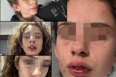 Konya'da genç kadına işkence yapan erkek serbest bırakıldı